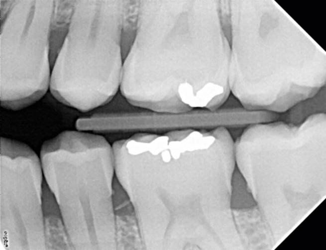 af97ded28037ab31a02c7f05a598c32a5cdd18f0