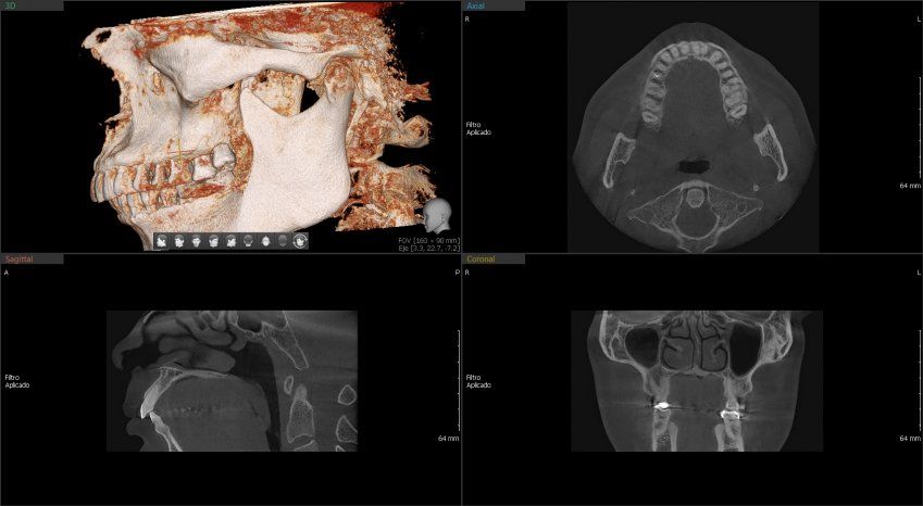 ci20201125 144250 2142 72259983