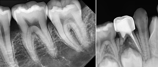 1 ezsensorclassic 08