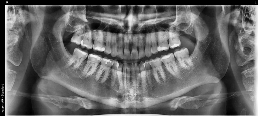 px20210105 150207 4677 98246706