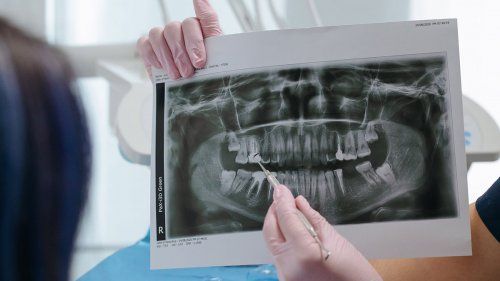 Equipos de radiología dental y lámparas de cirugía