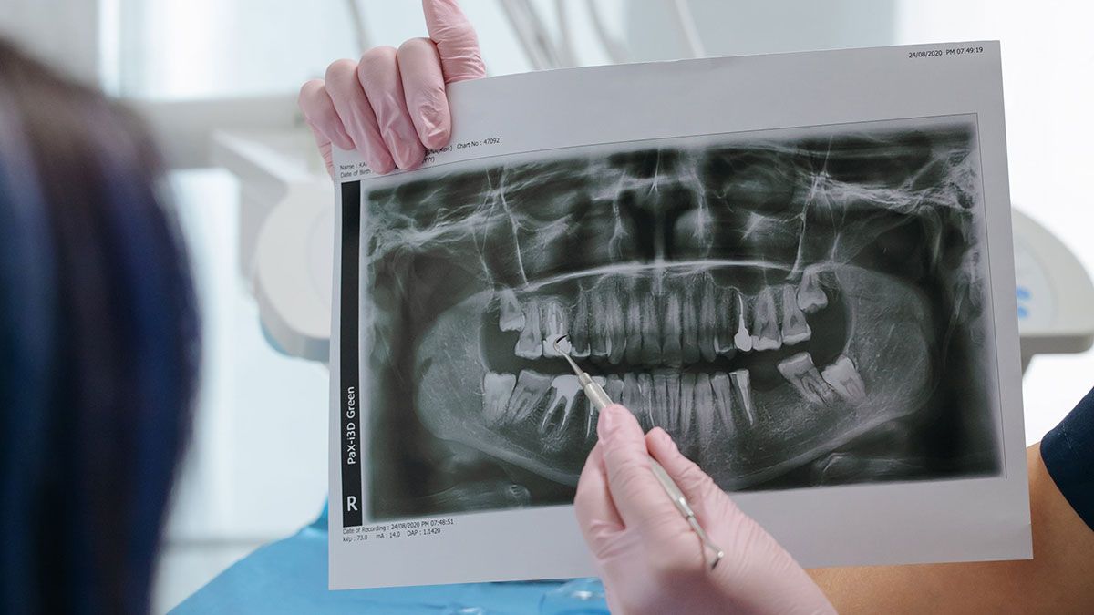 Equipos de radiología dental y lámparas de cirugía